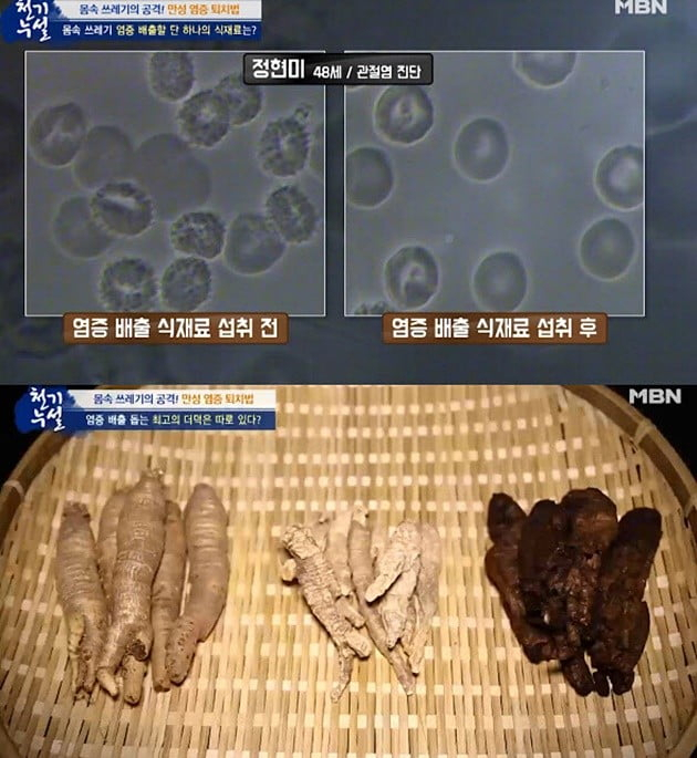 사진=MBN '천기누설' 캡처